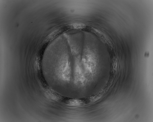 X0000099940316200806201127
