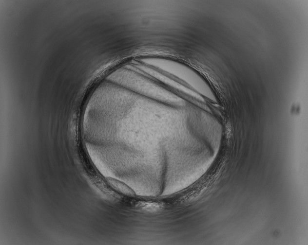 X0000099940352200806201126