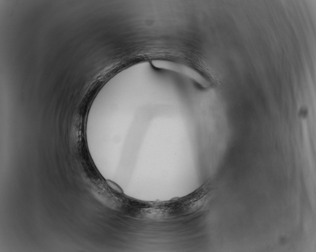 X0000099940356200806201126