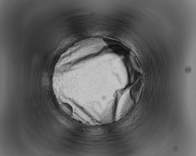 X0000099940357200806201126