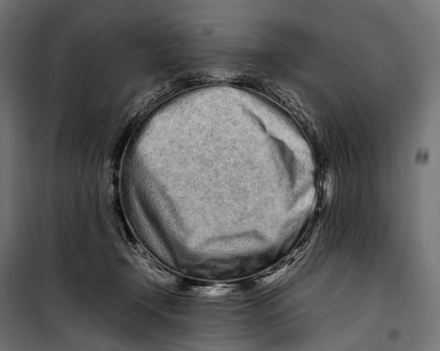 X0000099940366200806201126