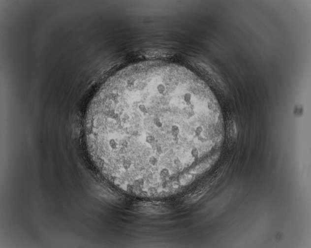 X0000099940367200806201126