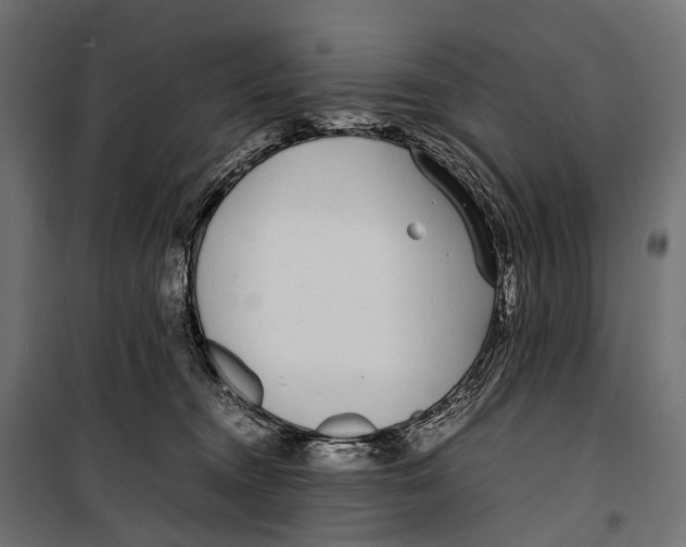 X0000099940372200806201126