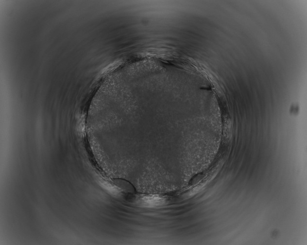 X0000099940383200806201126