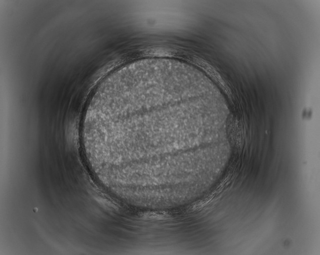 X0000099940386200806201125