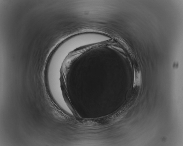 X0000099940387200806201125