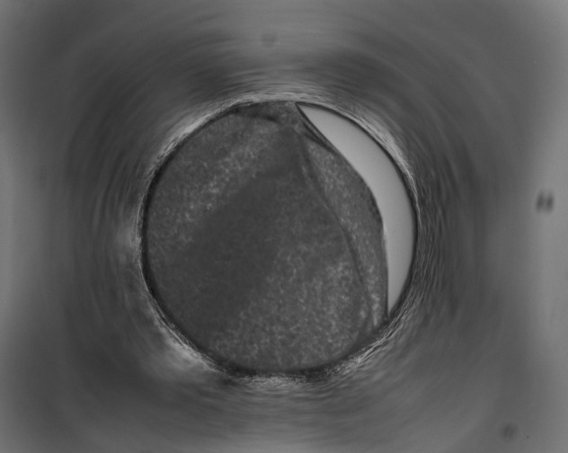 X0000099940389200806201125