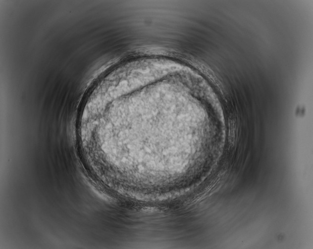 X0000099940390200806201125