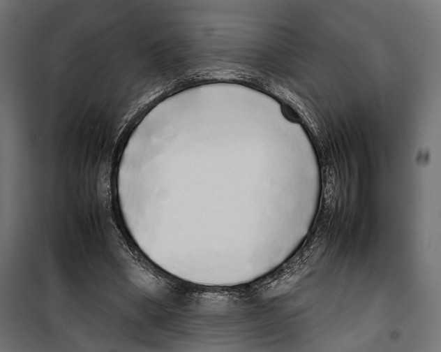X0000099940394200806201125