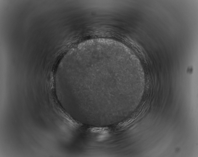 X0000099940465200806201125