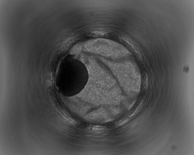 X0000099940467200806201125