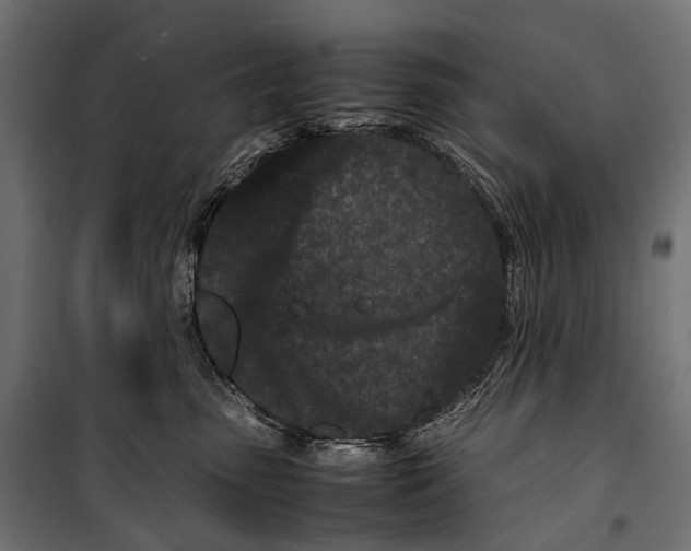 X0000099940475200806201125