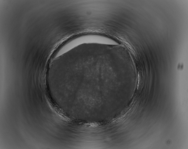 X0000099940492200806201124