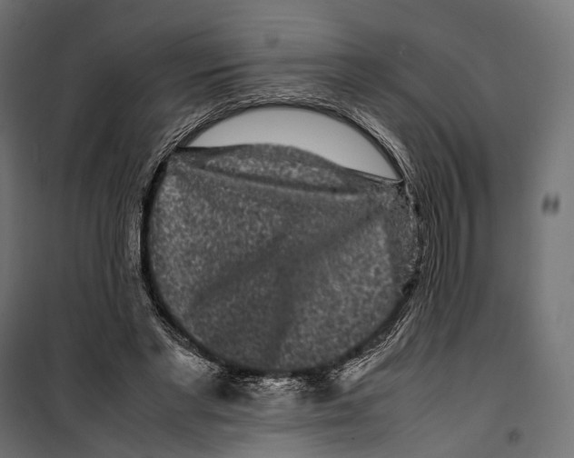 X0000099940493200806201124