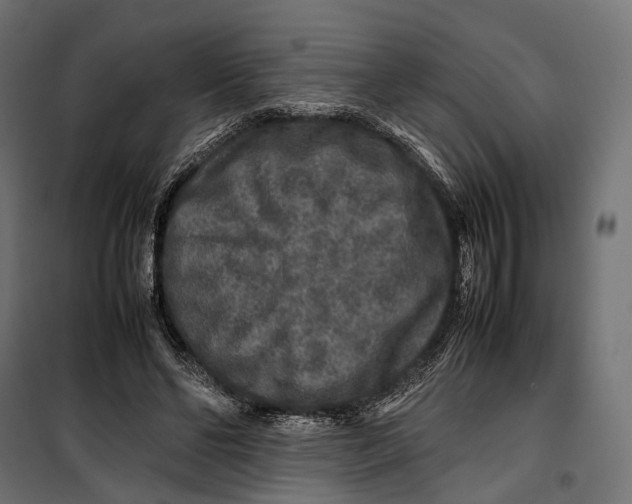 X0000099940494200806201124