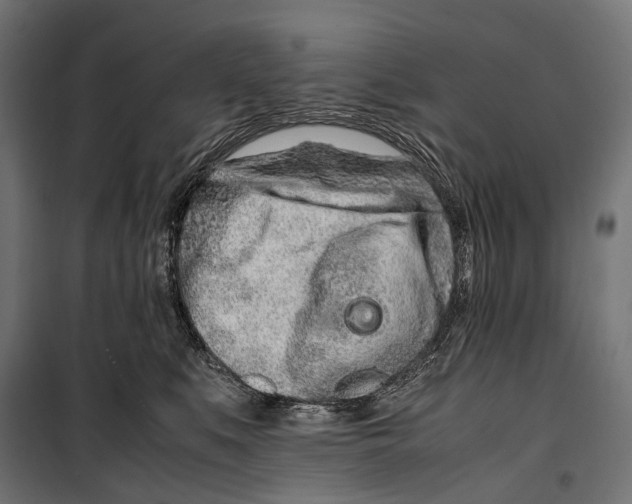 X0000099940519200806201123