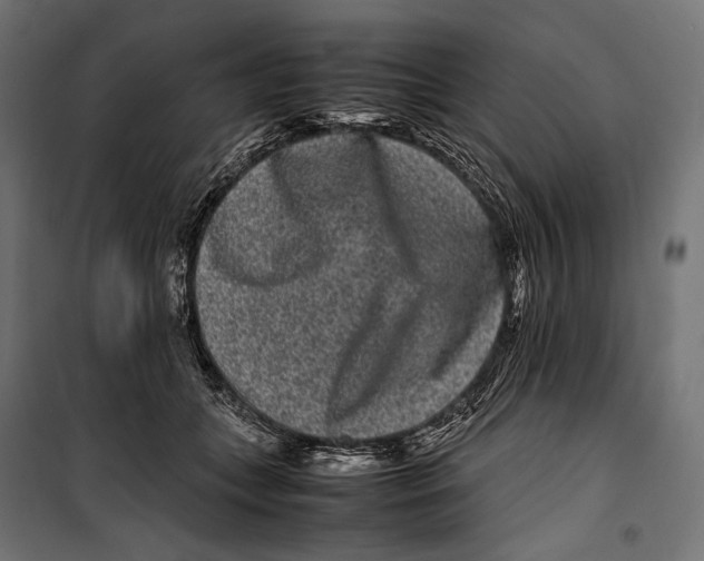 X0000099940559200806201123