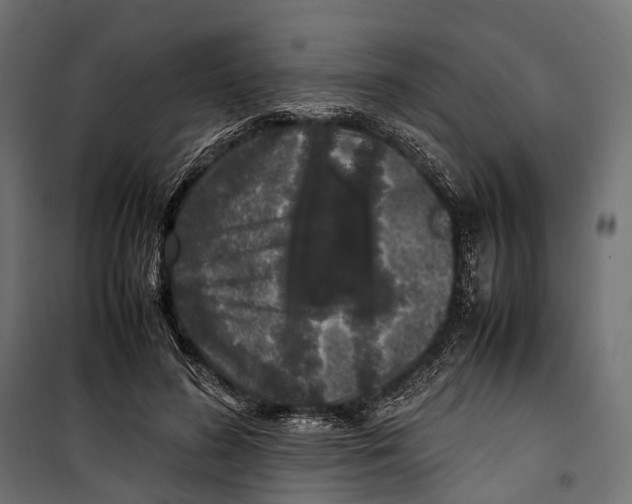 X0000099940596200806201122