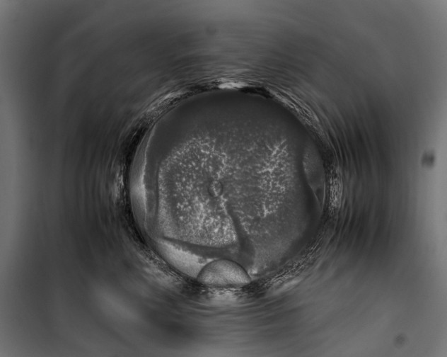 X0000099940618200806201122