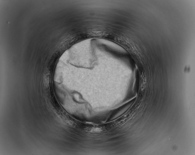 X0000099940647200806201121