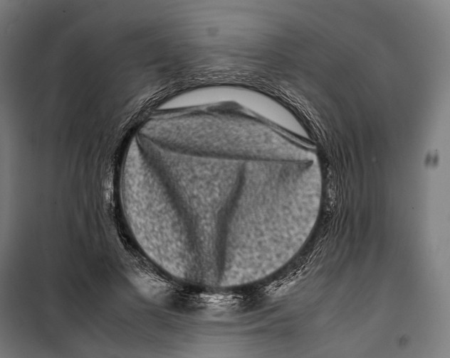 X0000099940693200806201121