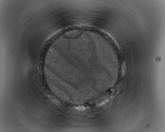 X0000099940919200806201116