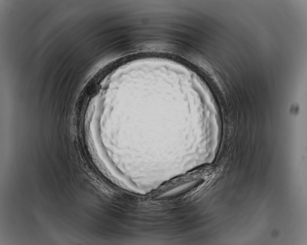 X0000099941019200806201115