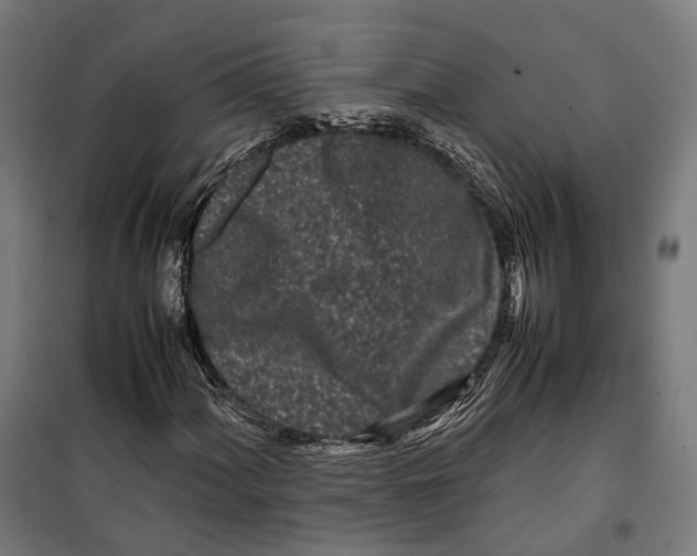 X0000099941060200806201115