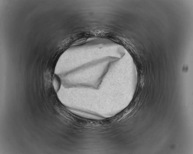 X0000099941106200806201114