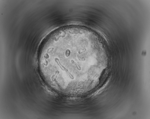 X0000099941117200806201114