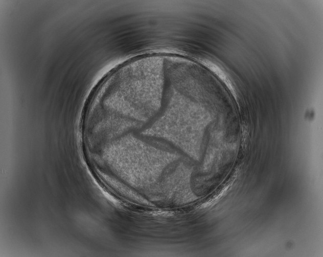 X0000099941141200806201114