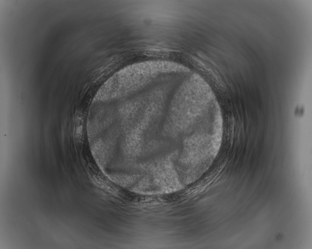 X0000099941154200806201113