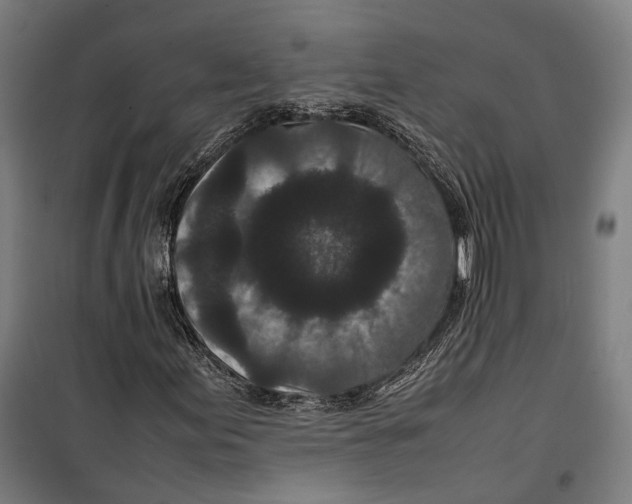 X0000099941155200806201113