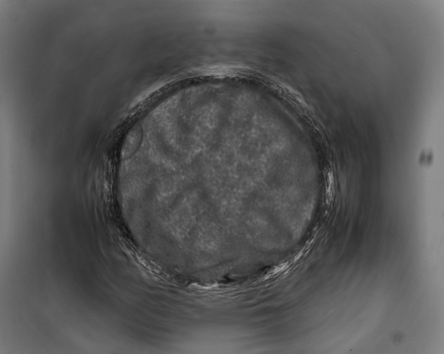X0000099941158200806201113