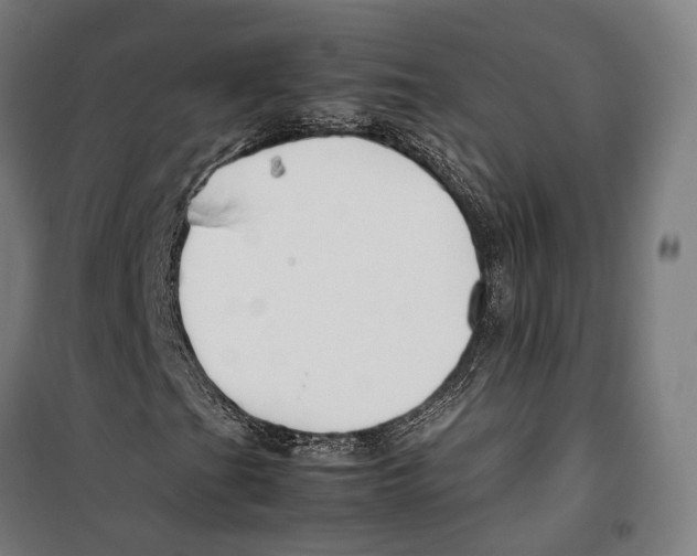 X0000099941201200806201112