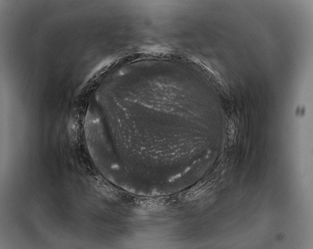 X0000099941254200806201112