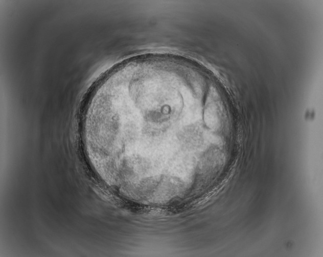 X0000099941263200806201112