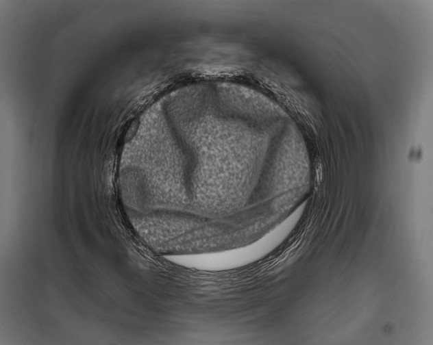 X0000099941300200806201111