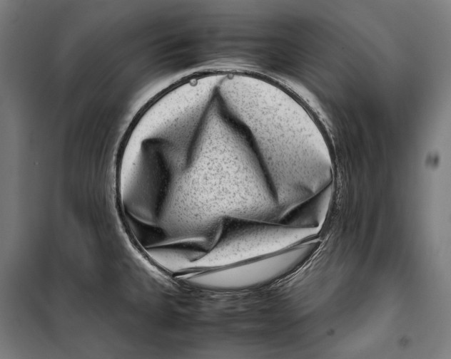 X0000099941335200806201111