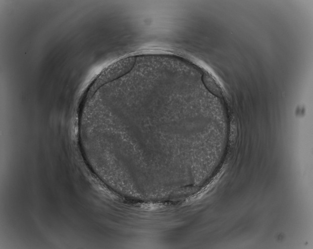 X0000099941461200806201109