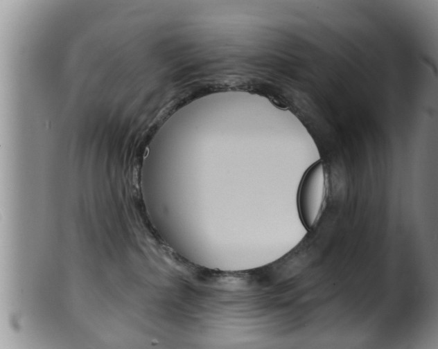 X0000099950236200805231009