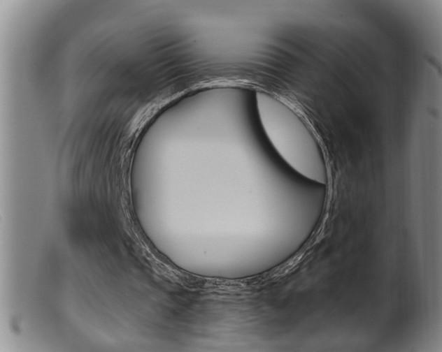 X0000099950337200805231007