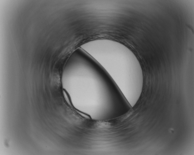 X0000099950617200805231003