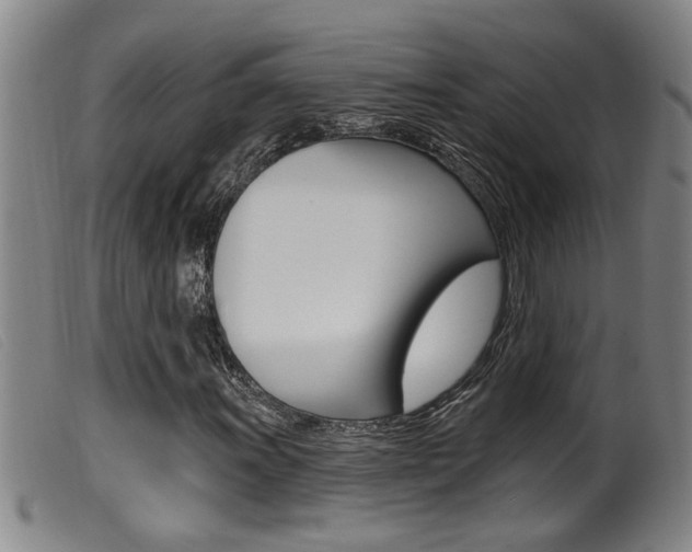 X0000099951011200805230956