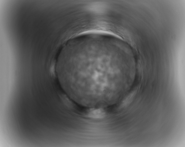 X0000099950185200805231329