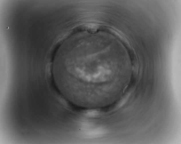 X0000099950462200805231325
