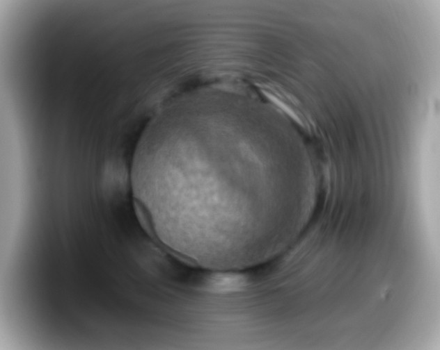 X0000099950617200805231323