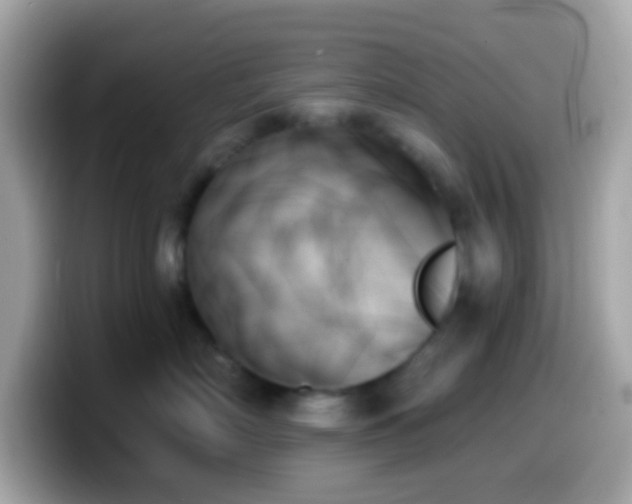 X0000099950718200805231322