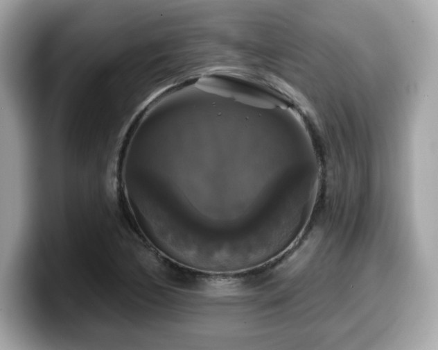 X0000099951170200805231315