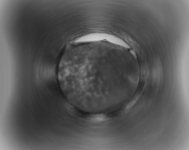 X0000099950377200805301241
